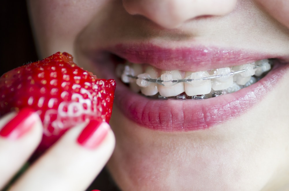 Eating With Orthodontic Braces - Cory Liss Orthodontics