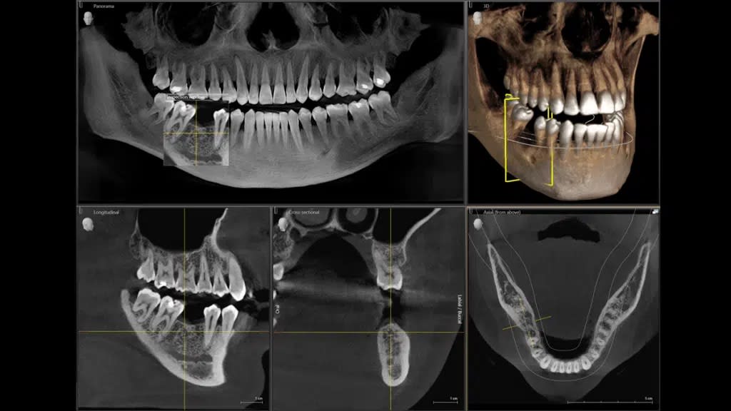 Various dental x-rays