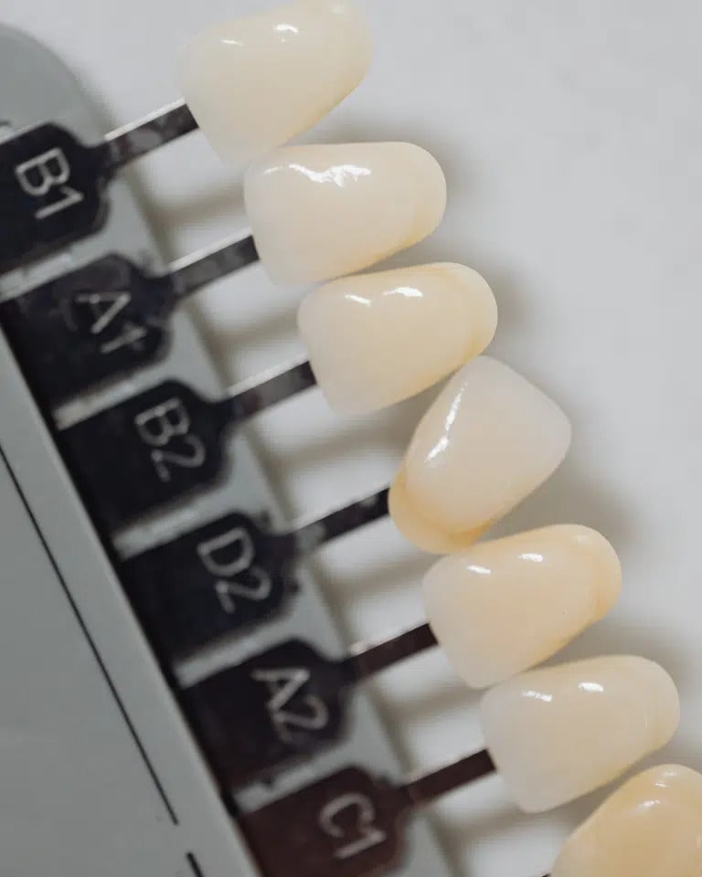 Teeth whitening colour chart