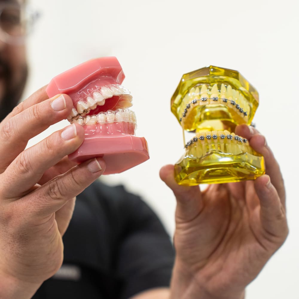 Clear Aligners or Braces at Cory Liss Orthodontics