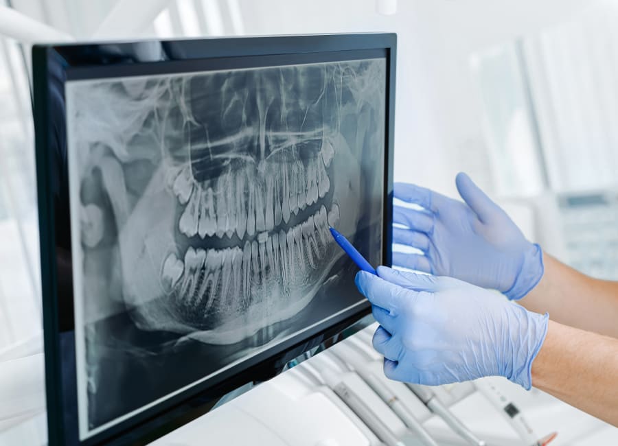 A dentist points to a panoramic X-ray.