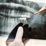 Calgary Orthodontist Explains Tooth Movement | Calgary