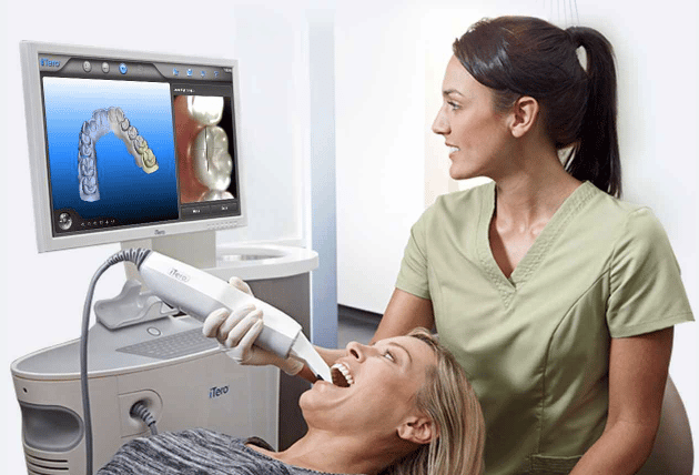 iTero Digital Scanner – Making Patient Comfort a Priority