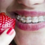 Eating with Braces