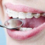 Orthodontics