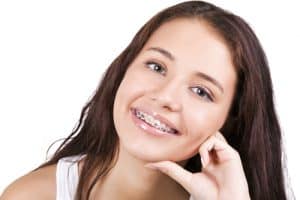 Fun Facts About Orthodontic Treatment in Calgary - Cory Liss Orthodontics