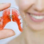 How Long Should I Wear My Orthodontic Retainer? - Cory Liss Ortho - Calgary Orthodontics