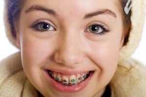 Are You Drooling Over Your Braces? | Calgary and Alberta