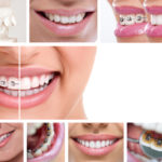 Invisalign Orthodontic Treatment - Cory Liss Orthodontics - NW Calgary Orthodontist