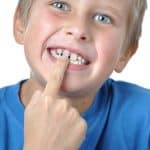 Why Do I Have a Gap Between my Front Teeth? - Cory Liss Orthodontics - NW Calgary Orthodontist