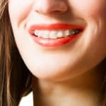 The Benefits of Accelerated Orthodontic Treatment - Cory Liss Orthodontics - Orthodontic Treatment Calgary