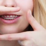 A Guide to the Perfect Selfie Smile - Cory Liss Orthodontics - Orthodontist in Calgary
