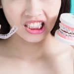 Treatment Options: Braces VS Invisalign - Cory Liss Orthodontics - Orthodontists in Calgary