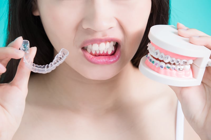 Treatment Options: Braces VS Invisalign - Cory Liss Orthodontics - Orthodontists in Calgary