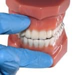 Daily Steps to Invisalign Success - Cory Liss Orthodontics - Orthodontics in Calgary