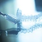 Invisalign FAQ - Cory Liss Orthodontics - Orthodontics in Calgary