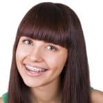 Watch Out for Mail Order Orthodontics - Cory Liss Orthodontics - Orthodontists in Calgary - Featured Image