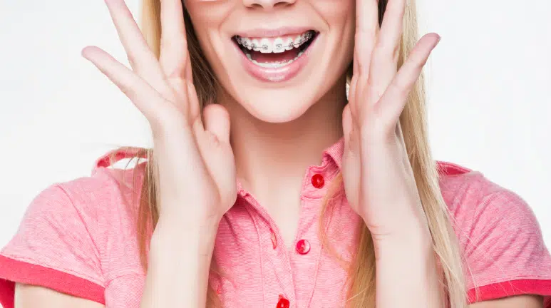 Metal braces are trending again